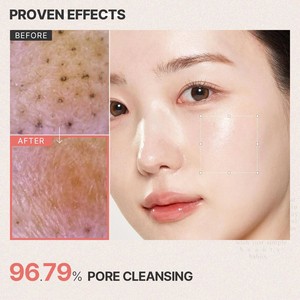 ETRUN ALISA OEM Private Label <span class=keywords><strong>Detergente</strong></span> Gel Puro Delicato con Acido Ialuronico, Pantenolo e Allantoina per la Cura dei Pori - Product Image 4
