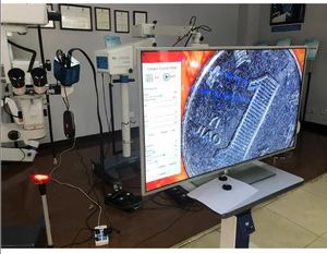 New <span class=keywords><strong>Vision</strong></span> yz20p5 hoạt động Kính hiển vi cho nhãn khoa, Ent và Nha khoa - Product Image 6