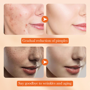 SADOER OEM Set <span class=keywords><strong>per</strong></span> la cura della pelle femminile avena siero <span class=keywords><strong>viso</strong></span> idratante emulsione lieve aminoacido Anti smagliature crema - Product Image 6