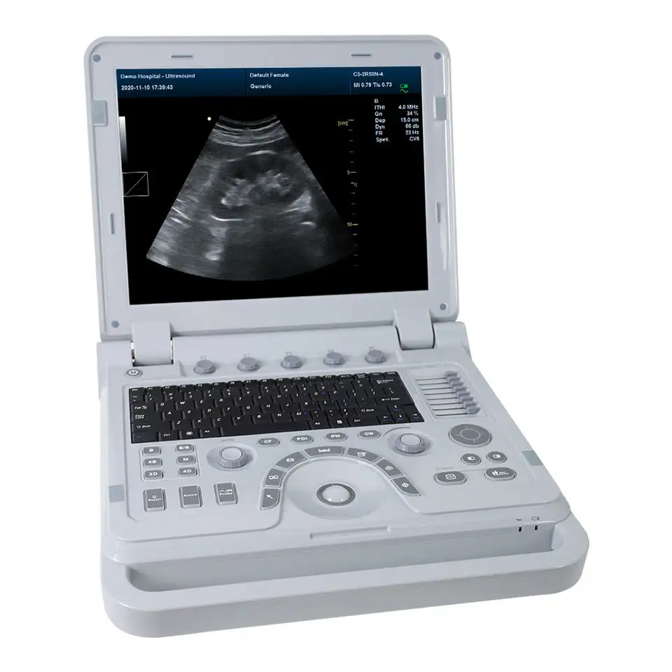 CONTEC CMS1700A Système d'imagerie ultrasonique portable pour des diagnostics précis