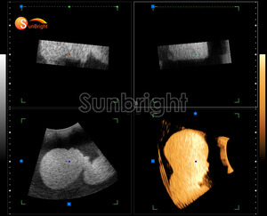 JM-906B Échographe Doppler Couleur à Haute Résolution d'Imagerie pour les Voies Vaskulaires Abdominales et les Petits Organes MSK, Sonde Linéaire, Appareil Doppler Couleur - Product Image 3