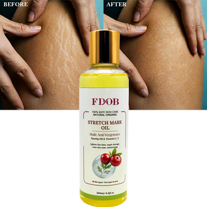 Huile de massage corporelle puissante et <span class=keywords><strong>efficace</strong></span> pour éliminer les vergetures, réparer la peau, raffermir et améliorer l'élasticité. - Product Image 2