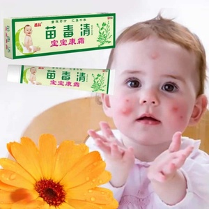Crema <span class=keywords><strong>de</strong></span> Fórmula Herbal China, Suave y Calmante, Alivia Efectivamente las Picaduras <span class=keywords><strong>de</strong></span> Mosquitos, Apta para Bebés y Niños - Product Image 1