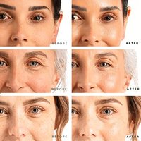 Sérum 3 en 1 BIO STEM CELL, FILLER, ADN, ANTI-RIDES, Raffermissant, EXTRAIT 100% NATUREL, Sérum Anti-Rides Blanchissant