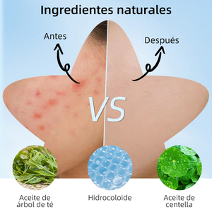 Parches Hidrocoloides para el Acné, Tratamiento Localizado para Granos e Imperfecciones, con Estuche con Espejo, Venta Caliente - Product Image 3