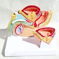 Modèle d'anatomie pelvienne masculine Yulin : Structure normale et structure de la prostate pour l'enseignement en urologie, démonstration de l'hyperplasie bénigne de la prostate