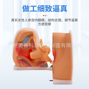 Enseñanza de la anatomía reproductiva femenina: cervix, útero, vagina y ovarios; orientación sobre la anticoncepción intrauterina; planificación familiar - Product Image 3