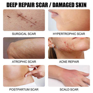 Crème avancée pour cicatrices, crème idéale pour les cicatrices anciennes, crème pour les cicatrices chéloïdes, TKA pour la vente au détail - Product Image 5