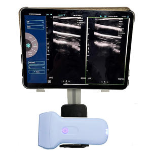 Pemindai Ultrasound nirkabel frekuensi tinggi <span class=keywords><strong>Probe</strong></span> <span class=keywords><strong>Linear</strong></span> lebar Super - Product Image 4