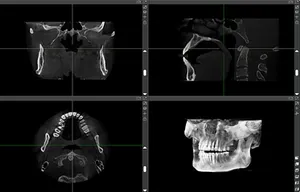 Macchina panoramica orale per apparecchiature dentali cbct macchina dentaria a cono