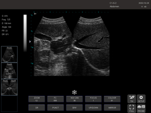 Tierärztliches Ultraschall-Diagnosesystem Schwarz-Weiß Veterinär-Ultraschallscanner mit Konvex-<span class=keywords><strong>Array</strong></span>-Sonde - Product Image 3