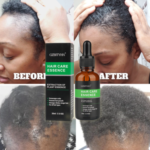 Aceite de Suero para el Crecimiento del Cabello Orgánico, Promueve la Salud del Cuero Cabelludo, Cuidado de la Piel, 30 ml, Aceite Capilar de Marca Privada, Ingredientes Herbales de Ginseng 100% - Product Image 3