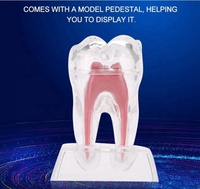 Boîte de dents artificielles standard pour la pratique dentaire des étudiants, dents naturelles agrandies, CE/ISO