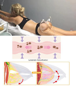 เครื่องนวดขยายหน้าอก 3 in 1 ยกกระชับก้น ด้วยระบบสุญญากาศ พร้อมถ้วยดูดและลูกกลิ้งบำบัด - Product Image 5