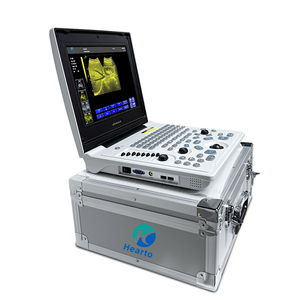 Máquina <span class=keywords><strong>de</strong></span> <span class=keywords><strong>Ultrasonido</strong></span> Médica Portátil <span class=keywords><strong>de</strong></span> Bajo <span class=keywords><strong>Precio</strong></span>, Imágenes en Blanco y Negro, Sonda Dual Convexa Lineal, Uso Veterinario y Humano - Product Image 2