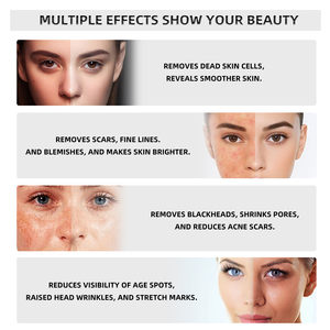 Máquina Facial Diamond Glow para Rejuvenecimiento de la Piel, 2 en 1, Hidrofacial con Punta de Diamante para Peeling - Product Image 3