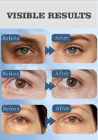 Crème pour les yeux à base de plantes OTVENA, élimine les poches sous les yeux, adieu les gonflements, réduit les cernes, réduit les ridules, anti-âge