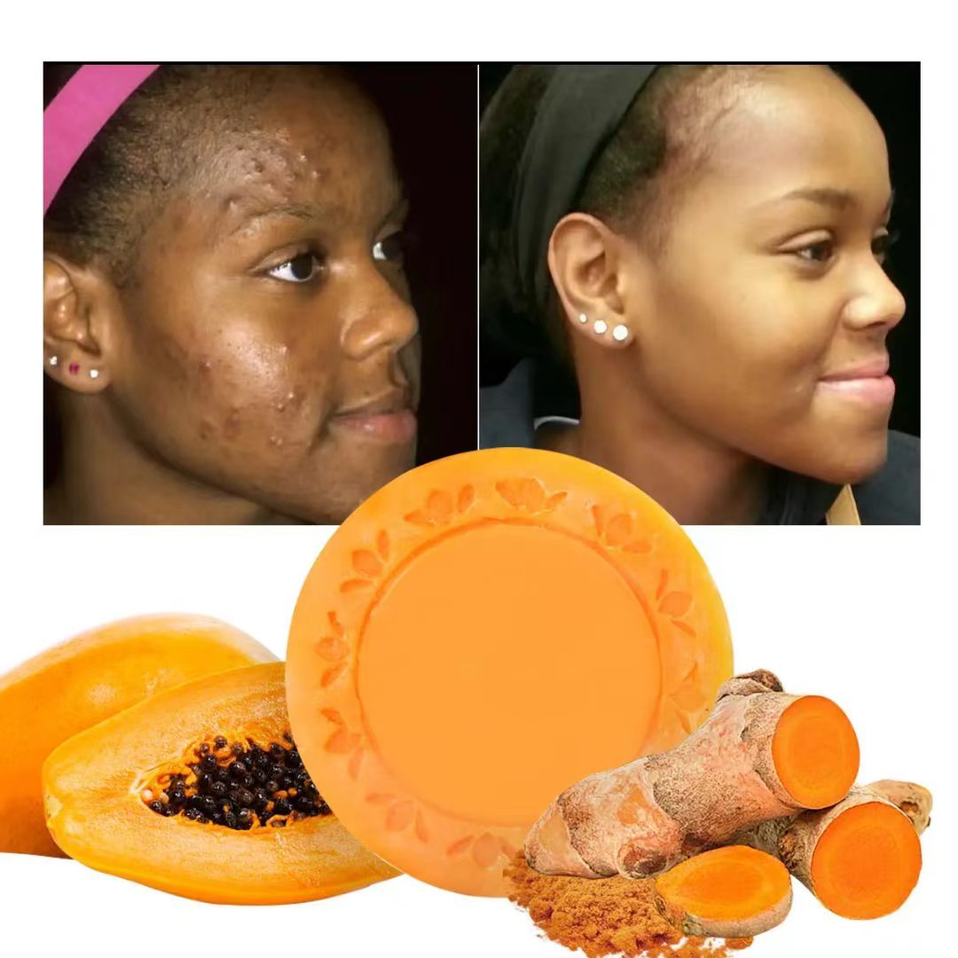 be organic papaya glutathione soap review Turmeric Handmade Bar Skin Whitening Lightening Oil Control Cleanser Dark Spot Remover Private Label OEM ODM OOS