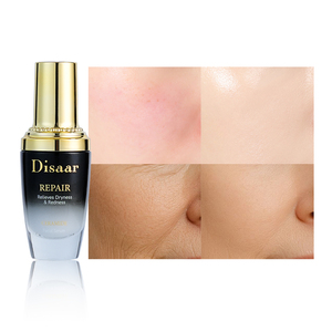 Suero Hidratante con Ceramidas para Todo Tipo de Piel, Reparación Profunda, Suero Facial para Piel Sensible - Product Image 5