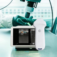 Escáner de Ultrasonido Doppler Inalámbrico Lineal Portátil Veterinario Eléctrico de 64 Canales, 192E, 16Mhz, 20Mhz