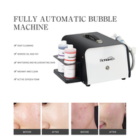 Machine à bulles d'oxygène de style japonais pour le traitement de l'acné, nettoyage en profondeur, réduction des pores, élimination des rides et hydratation du visage