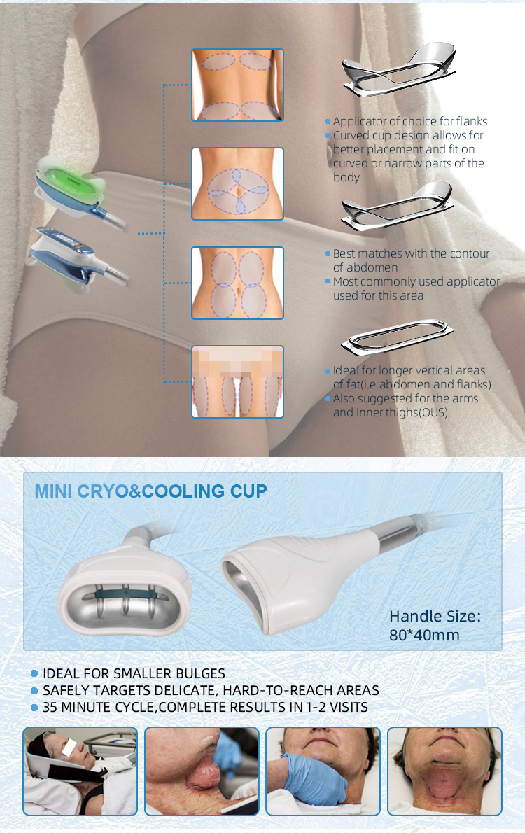 Cryo 360 Fat Freeze Machine Fat Freezing Rf Machine Face Body 360 Cryo 360 Cryo Slimming Machine