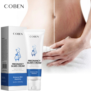 Crème <span class=keywords><strong>Anti</strong></span>-Vergetures Maternité 100% Naturelle et Végane Pour le Ventre, la Poitrine, les Hanches et les Cuisses – Élimine l'Acné Post-Partum et les Cicatrices - Product Image 2