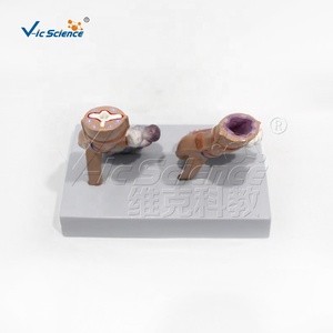 Modelo <span class=keywords><strong>de</strong></span> Comparación <span class=keywords><strong>de</strong></span> Pulmones: Pulmón Saludable vs. Pulmón <span class=keywords><strong>de</strong></span> <span class=keywords><strong>Fumador</strong></span> con Base, Herramienta Educativa para el Control del Tabaco - Product Image 4