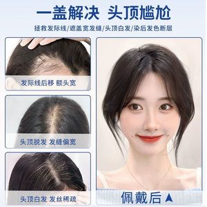 Toupee para mujer, cabello humano real, simula el cuero cabelludo, cubre las canas, flequillo, para cualquier forma de rostro - Product Image 3