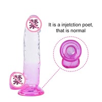 7 Zoll Umweltfreundlicher 100% Wasserdichter Realistischer Silikon-Vibrator Anpassbare Gel-Farbe Saugnapf Weibliches Masturbationsspielzeug Weich