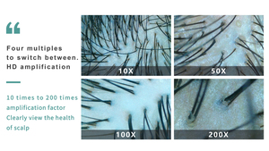 Nuevo Analizador Inteligente de Cuero Cabelludo con IA, Informe de Prueba Capilar, Escaneo de Folículos Pilosos, Máquina de Análisis para Salón de Belleza - Product Image 4