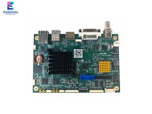 पोर्टेबल एंडोस्कोप कैमरा 4K एंडोस्कोप कैमरा सिस्टम अंतर्निहित कार्य स्टेशन मेडिकल एंडोस्कोपी मॉड्यूल - Product Image 2