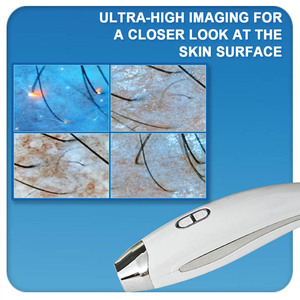 Appareil de nettoyage en profondeur Hydra 15-en-1 <span class=keywords><strong>2026</strong></span>, microdermabrasion, rajeunissement cutané, soin du visage portable, jet d'oxygène, analyseur d'eau - Product Image 4