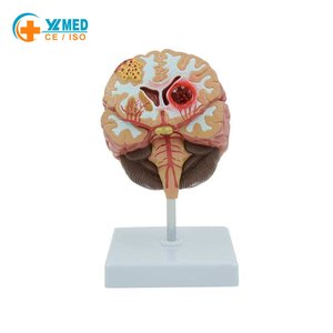 Modelo de Patología Cerebral de PVC Reutilizable, Modelo de Demostración de Anatomía de Hemorragia Cerebral y Malformación Arteriovenosa, Certificado CE/ISO - Product Image 1