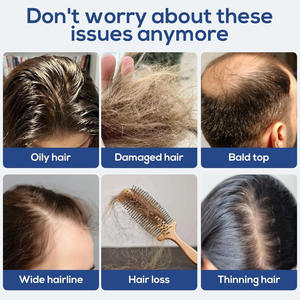 Electric Scalp Massage Device Oil Applicator Comb Hairbrush for Hair Loss & Growth Hair Care Comb - Product Image 5