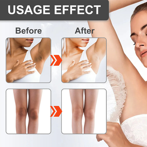 Crema Blanqueadora con Niacinamida para Áreas Sensibles, Aclara la Piel del Rostro, Cuerpo, Axilas y Entrepierna en 7 Días - Product Image 6