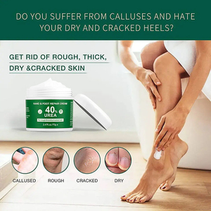 Crème pour les pieds à <span class=keywords><strong>l</strong></span>'<span class=keywords><strong>urée</strong></span> et au beurre <span class=keywords><strong>de</strong></span> karité <span class=keywords><strong>de</strong></span> haute qualité, végane, blanchissante, pour éliminer les peaux mortes des talons, réparation des pieds - Product Image 5