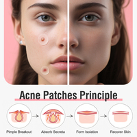 Patchs Hydrocolloïdes Anti-Acné Personnalisés à Marque Blanche, Infusés à l'Acide Salicylique et à l'Huile d'Arbre à Thé, Traitement Localisé pour le Visage – Vente Directe Usine