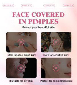 Ance Custom Ingredients Pimple <strong>Patch</strong> Organic Round Heart Shape 12mm Sulfer and Salicylic Acid <strong>Dark</strong> <strong>Spot</strong> Remover for Acne - Product Image 2