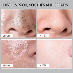 Kit de Cuidado Facial <span class=keywords><strong>para</strong></span> <span class=keywords><strong>Hombre</strong></span> de Marca Privada PM/AM, Limpiador, Tónico y Loción Diarios Simples <span class=keywords><strong>para</strong></span> OEM/ODM, Set de Cuidado Facial Masculino - Product Image 6