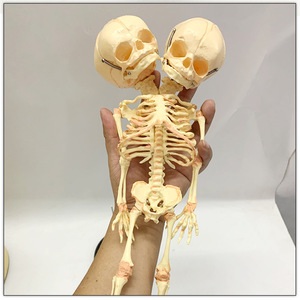Medical Teaching Model Halloween Decoration <strong>Baby</strong> <strong>Skeleton</strong> Model 2-Headed Fetal <strong>Skeleton</strong> Deformity Newborn Infant <strong>Skeleton</strong> Model - Product Image 2