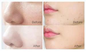 Eigenmarke Schlussverkauf Gesichtsmaske grüne Teebaum-Ton-Maske für Hautpflege gesichtspflege - Product Image 6