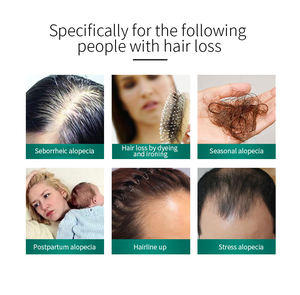 Champú para el Crecimiento del Cabello de Marca Privada Personalizado para la Pérdida de Cabello <span class=keywords><strong>y</strong></span> el Recrecimiento del Cabello, Control de Grasa e Hidratación - Product Image 3