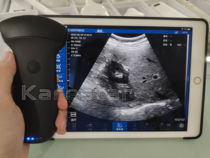 Échographe vétérinaire portable sans fil K-DCX200, scanner USG amovible et remplaçable - Product Image 6