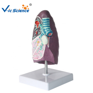 Modelo patológico de pulmón humano con enfermedades, modelo de pulmón visceral de fumador, modelo de enseñanza del sistema respiratorio - Product Image 3