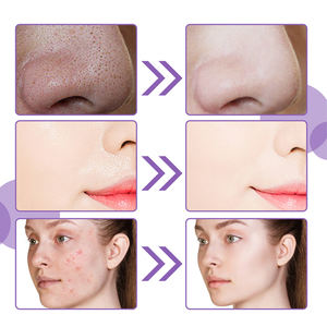 Mascarilla Facial Burbujeante de Oxígeno, Hidratante, Iluminadora y Purificante de Piel, Marca Privada, Color Morado - Product Image 6