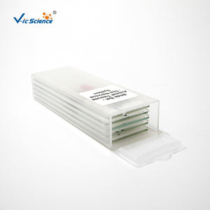 Oferta Especial: Juego de Cinco Portaobjetos Preparados de Punta de Raíz de Cebolla para <span class=keywords><strong>Mitosis</strong></span> - Product Image 3