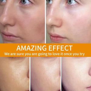 Custom OEM Dark Spots Hydrating Moisturizing <b>Cream</b> Glowing Skin Niacinamide <b>Vitamin</b> C <b>Cream</b> Face - Product Image 4