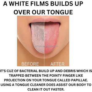 Grattoir à langue en cuivre pur brosse de nettoyage buccal hygiène de nettoyage fraîche grattoir à langue de haute qualité - Product Image 6