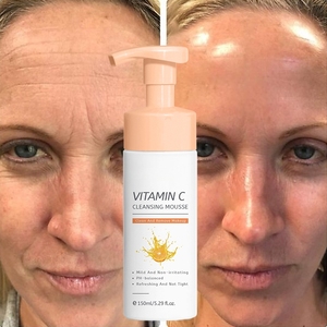 Nettoyant moussant pour le visage aux pores profonds avec vitamine C, lingettes nettoyantes, soin nettoyant en profondeur pour peaux grasses - Product Image 1